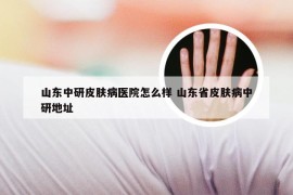 山东中研皮肤病医院怎么样 山东省皮肤病中研地址