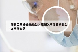 胳膊关节处长癣怎么办 胳膊关节处长癣怎么办用什么药