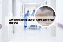 吉林银屑病医院华山选定 吉林银屑病专科医院哪家好