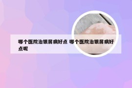 哪个医院治银屑病好点 哪个医院治银屑病好点呢