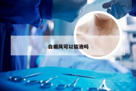 白癜风可以输液吗