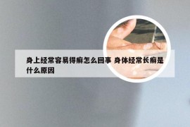 身上经常容易得癣怎么回事 身体经常长癣是什么原因