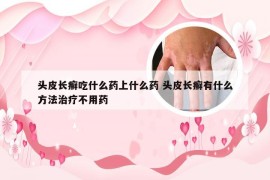 头皮长癣吃什么药上什么药 头皮长癣有什么方法治疗不用药