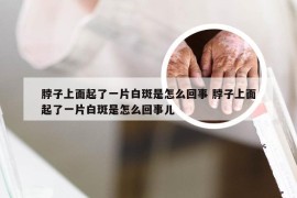 脖子上面起了一片白斑是怎么回事 脖子上面起了一片白斑是怎么回事儿