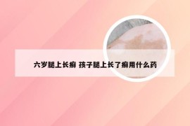 六岁腿上长癣 孩子腿上长了癣用什么药