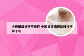 中医银屑病医院排行 中医银屑病医院排行榜前十名