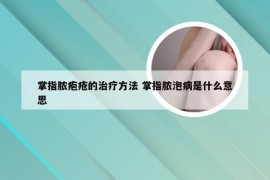 掌指脓疱疮的治疗方法 掌指脓泡病是什么意思