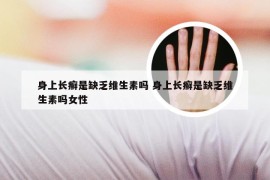 身上长癣是缺乏维生素吗 身上长癣是缺乏维生素吗女性