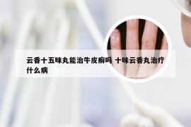 云香十五味丸能治牛皮癣吗 十味云香丸治疗什么病