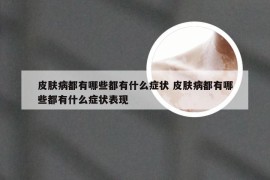 皮肤病都有哪些都有什么症状 皮肤病都有哪些都有什么症状表现