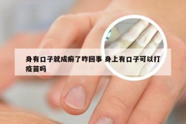 身有口子就成癣了咋回事 身上有口子可以打疫苗吗