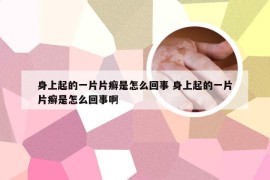 身上起的一片片癣是怎么回事 身上起的一片片癣是怎么回事啊