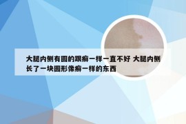 大腿内侧有圆的跟癣一样一直不好 大腿内侧长了一块圆形像癣一样的东西