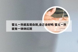 婴儿一热就出现白斑,自己会好吗 婴儿一热就有一块块红斑