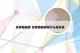 皮肤粗糙痒 皮肤粗糙痒缺什么维生素