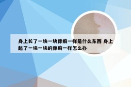 身上长了一块一块像癣一样是什么东西 身上起了一块一块的像癣一样怎么办