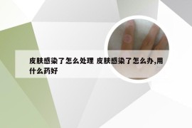 皮肤感染了怎么处理 皮肤感染了怎么办,用什么药好