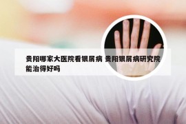 贵阳哪家大医院看银屑病 贵阳银屑病研究院能治得好吗