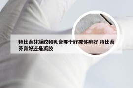 特比萘芬凝胶和乳膏哪个好抹体癣好 特比萘芬膏好还是凝胶