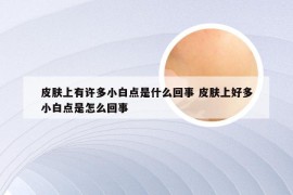 皮肤上有许多小白点是什么回事 皮肤上好多小白点是怎么回事