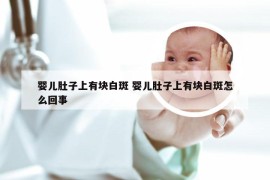 婴儿肚子上有块白斑 婴儿肚子上有块白斑怎么回事