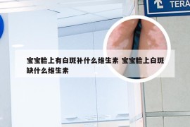 宝宝脸上有白斑补什么维生素 宝宝脸上白斑缺什么维生素