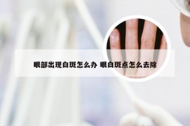 眼部出现白斑怎么办 眼白斑点怎么去除