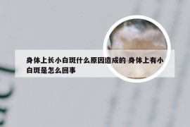 身体上长小白斑什么原因造成的 身体上有小白斑是怎么回事