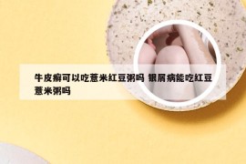 牛皮癣可以吃薏米红豆粥吗 银屑病能吃红豆薏米粥吗