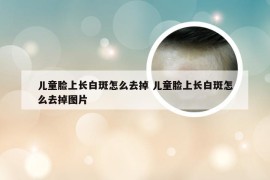 儿童脸上长白斑怎么去掉 儿童脸上长白斑怎么去掉图片