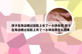 孩子在海边晒过后脸上长了一小块白斑 孩子在海边晒过后脸上长了一小块白斑怎么回事