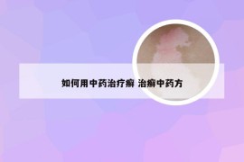 如何用中药治疗癣 治癣中药方