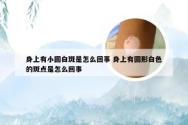 身上有小圆白斑是怎么回事 身上有圆形白色的斑点是怎么回事