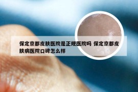 保定京都皮肤医院是正规医院吗 保定京都皮肤病医院口碑怎么样