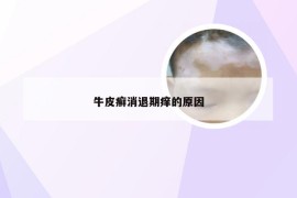 牛皮癣消退期痒的原因