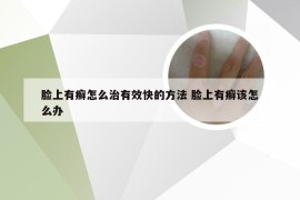 脸上有癣怎么治有效快的方法 脸上有癣该怎么办