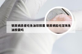 银屑病患者吃鱼油软胶囊 银屑病能吃深海鱼油胶囊吗