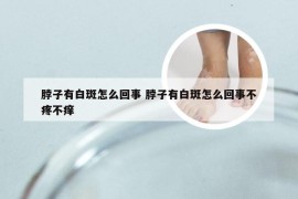 脖子有白斑怎么回事 脖子有白斑怎么回事不疼不痒