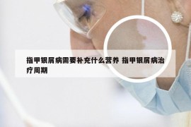 指甲银屑病需要补充什么营养 指甲银屑病治疗周期