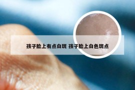 孩子脸上有点白斑 孩子脸上白色斑点