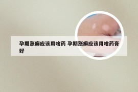 孕期涨癣应该用啥药 孕期涨癣应该用啥药膏好