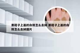 黑鞋子上面的白斑怎么去掉 黑鞋子上面的白斑怎么去掉图片