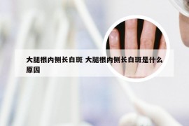 大腿根内侧长白斑 大腿根内侧长白斑是什么原因