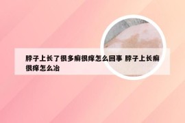 脖子上长了很多癣很痒怎么回事 脖子上长癣很痒怎么冶