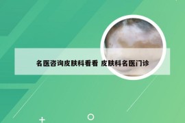 名医咨询皮肤科看看 皮肤科名医门诊