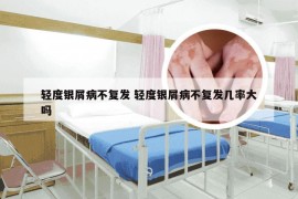 轻度银屑病不复发 轻度银屑病不复发几率大吗