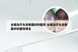 全国治疗头皮癣最好的医院 全国治疗头皮癣最好的医院排名