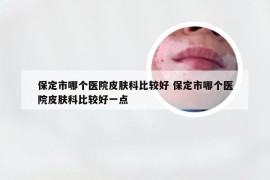 保定市哪个医院皮肤科比较好 保定市哪个医院皮肤科比较好一点