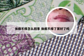 体癣不痒怎么回事 体癣不痒了算好了吗