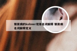 银屑病的kobner现象名词解释 银屑病名词解释定义